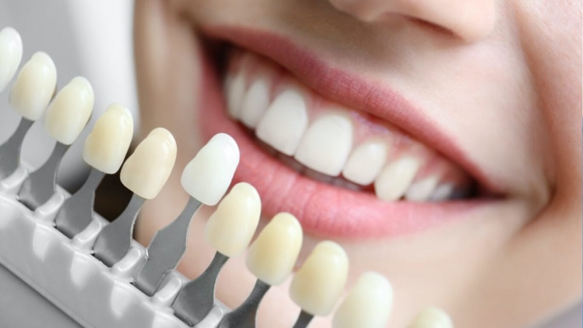 Do Veneers Hurt? What You Should Know Before Your Procedure