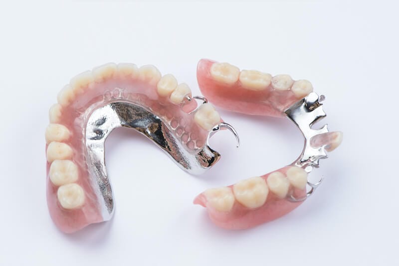 partial denture