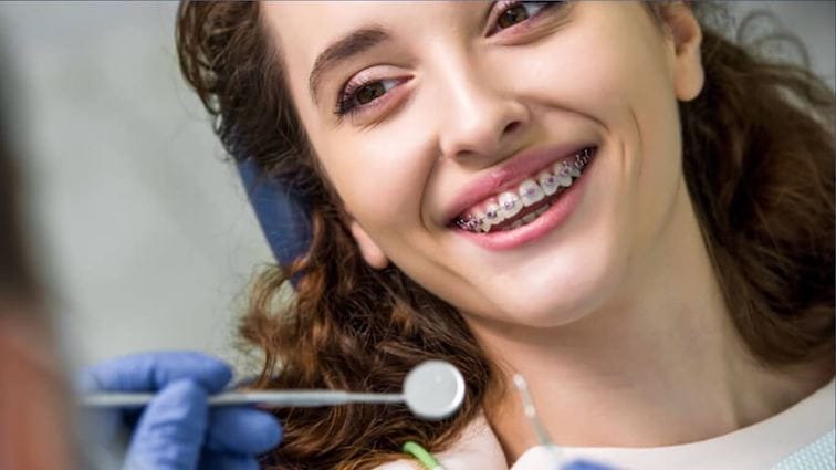 woman showing Invisalign aligner