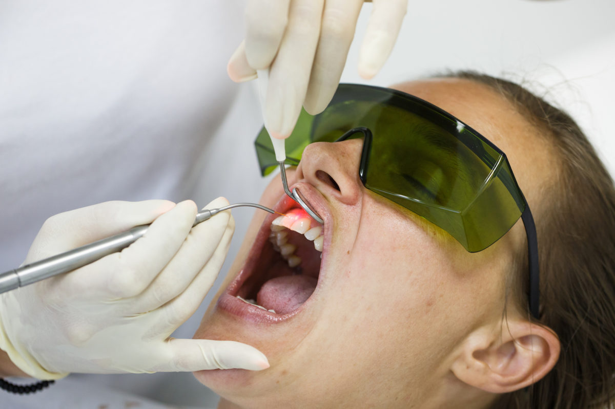 5 Facts About Laser Dentistry