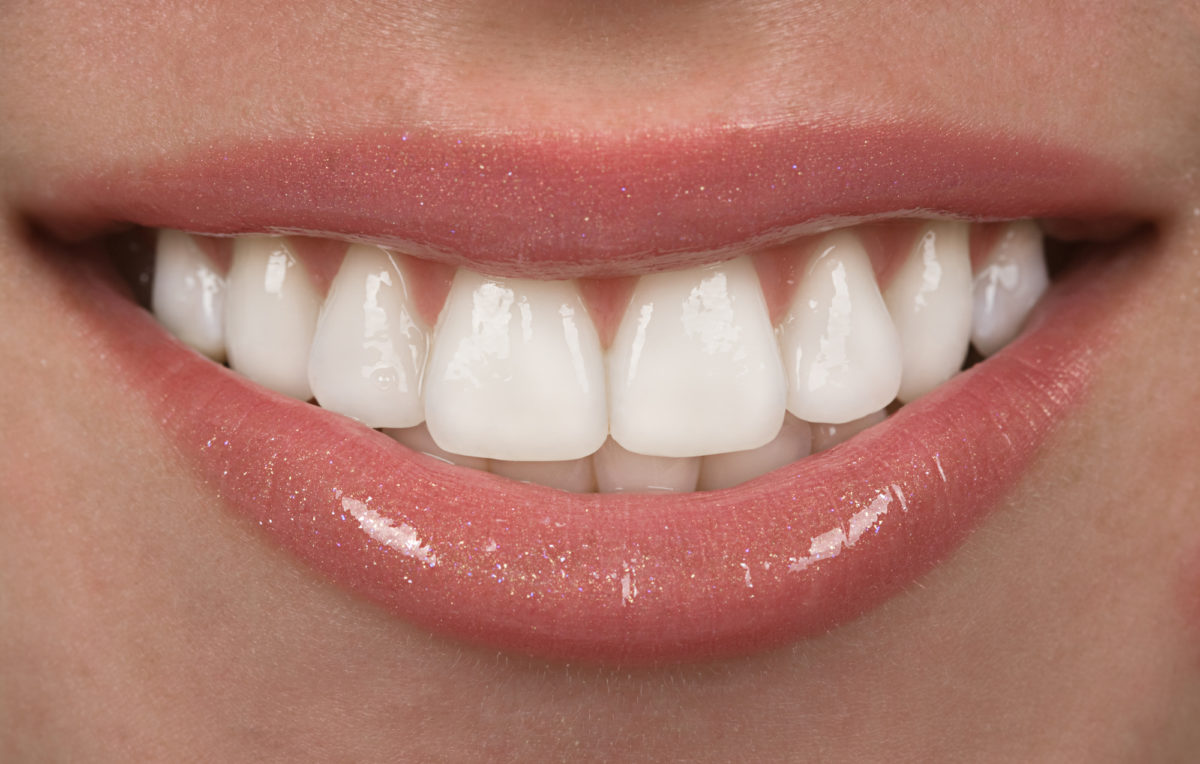 Invisalign Cost: How Much Is It and Is It Worth It?