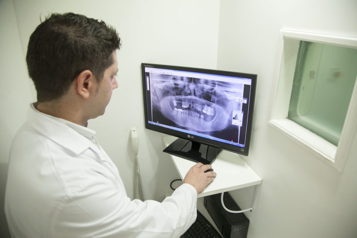 5 Benefits of Digital X-Rays