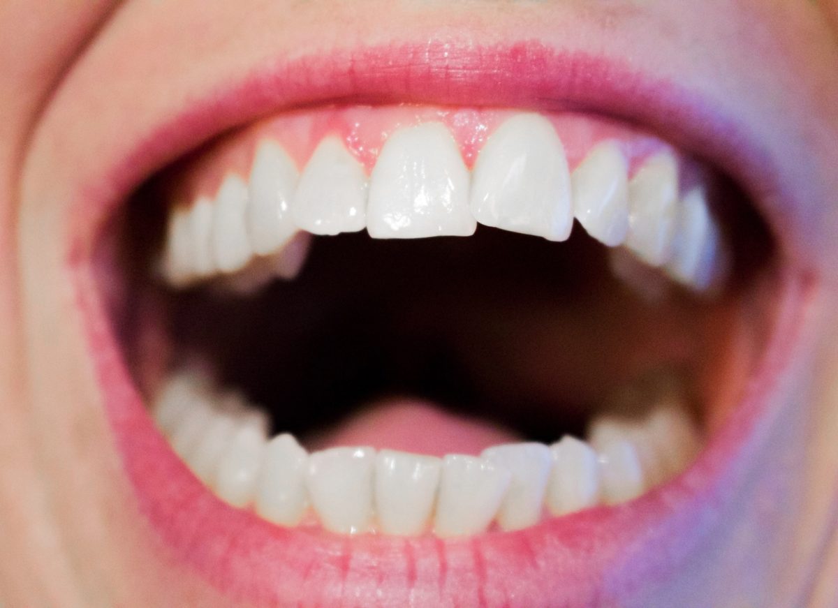 What Is the Solution for a Discolored Tooth?